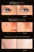 Load image into Gallery viewer, Photon Skin Rejuvenation Mask